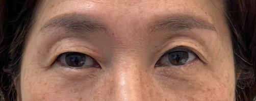 라이블리성형외과의원 이미지