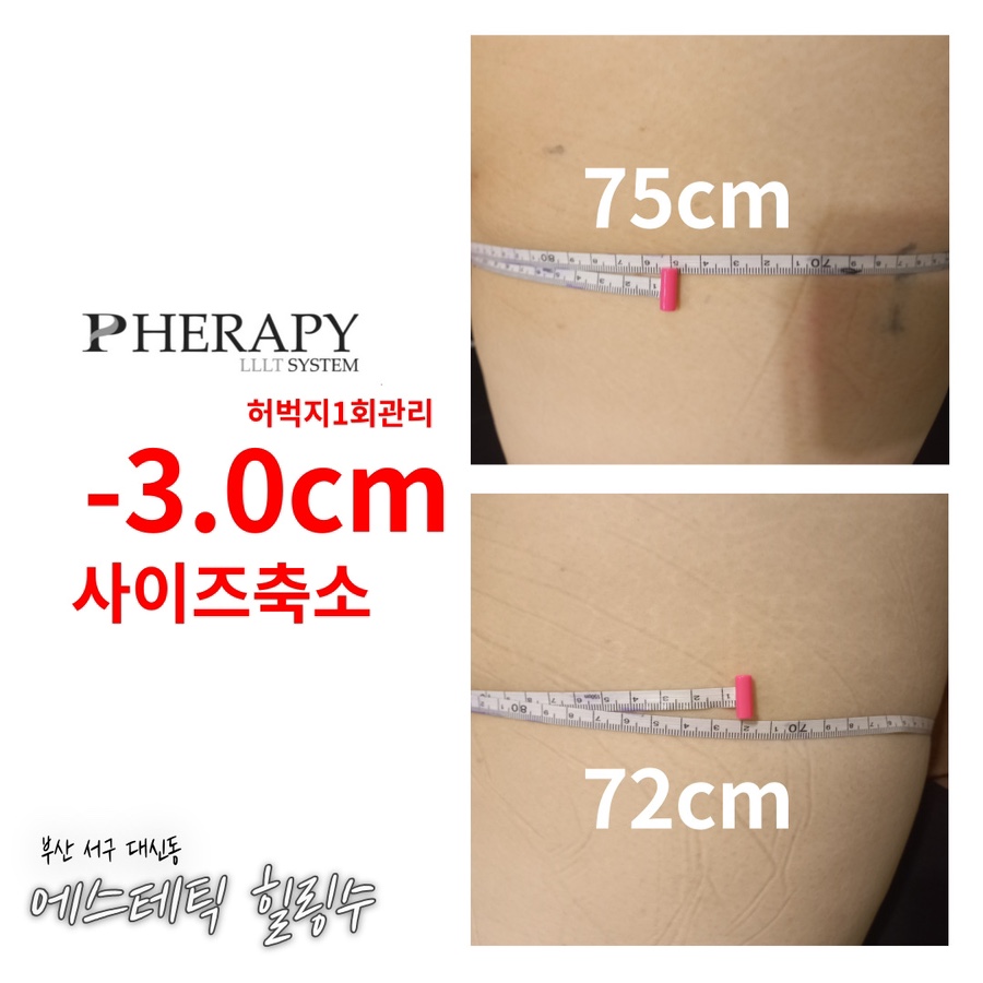 에스테틱 힐링수 이미지