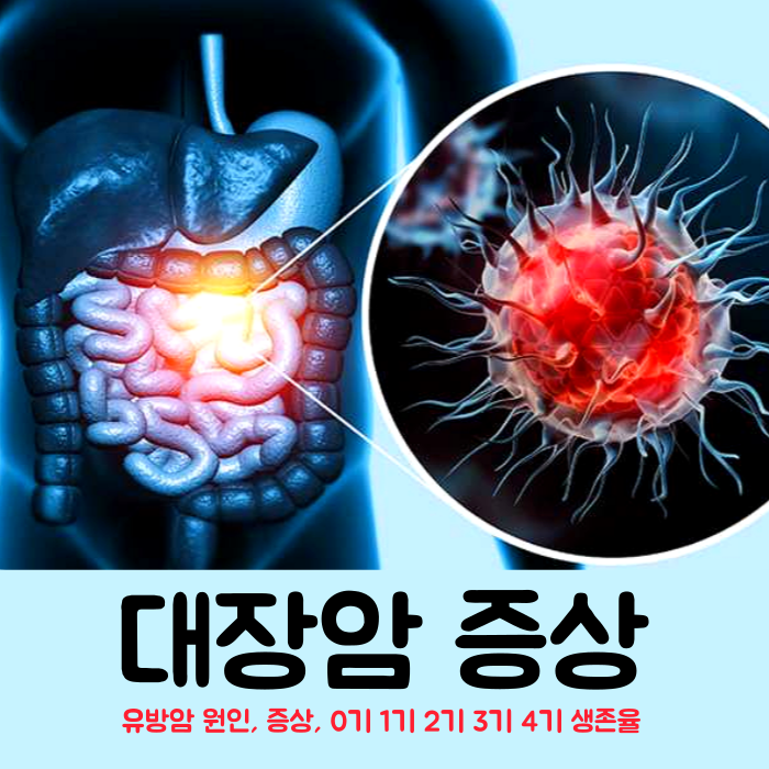 대장암 초기증상(+말기) 및 3기 4기 생존율 : 혈변 가는변 점액변 대장암 원인 : 네이버 블로그