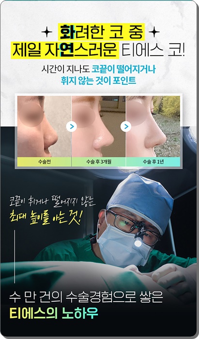 한코티에스 이미지