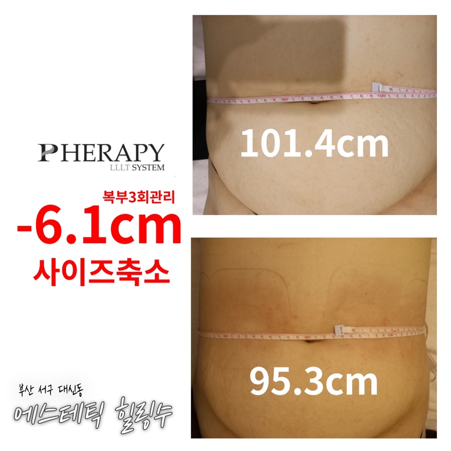 에스테틱 힐링수 이미지