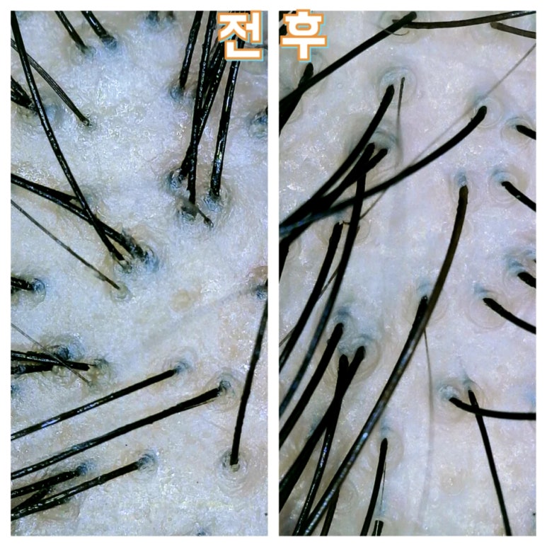 숲칼프보라매 이미지