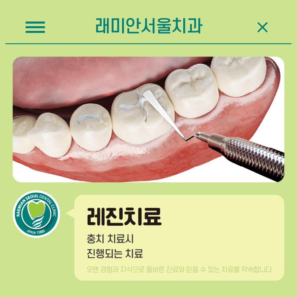 서울빛치과의원 이미지