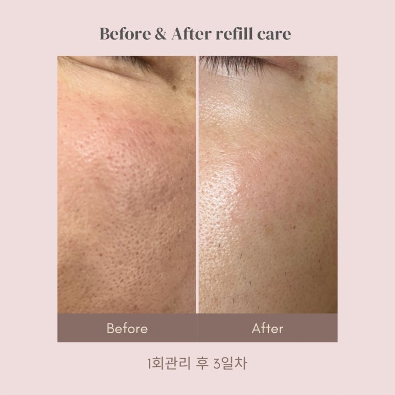 프롬미 이미지