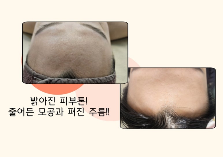 숲칼프 동대구역점 이미지