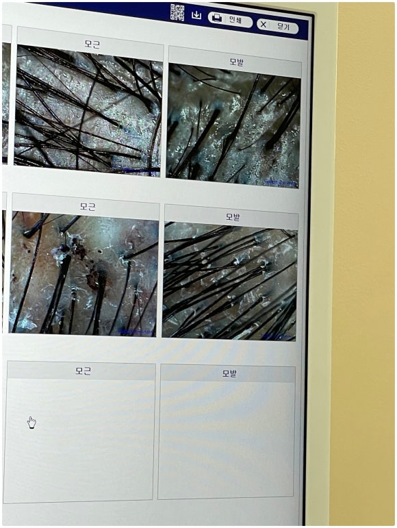 모바이오두피크리닉 이미지