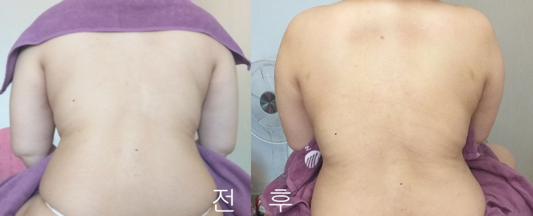 출장마사지 이미지