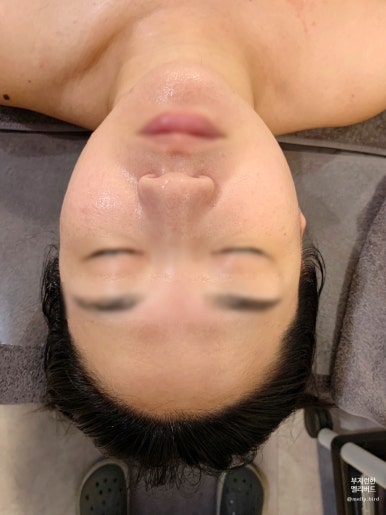모어샤인스킨바디 이미지