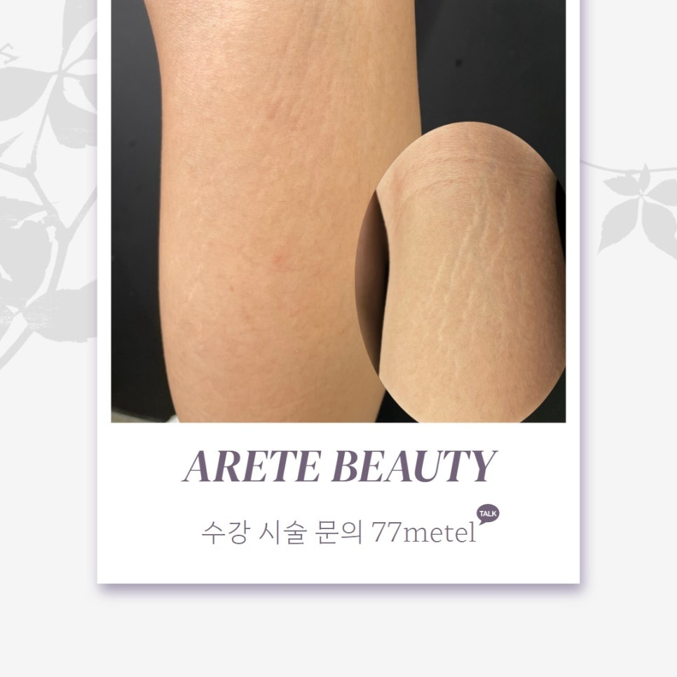 52아레테 이미지