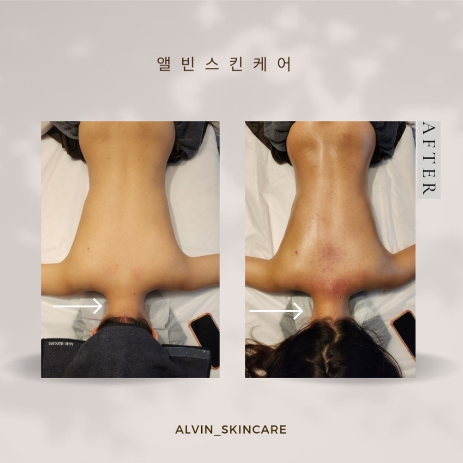 앨빈스킨케어 이미지