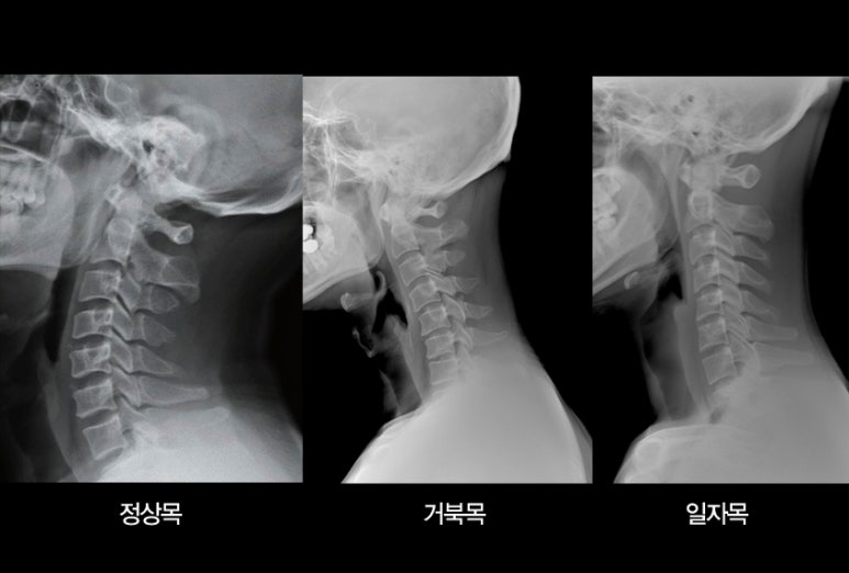 창원더리햅 이미지