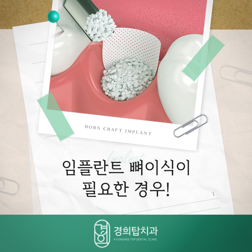 경희탑치과의원 이미지
