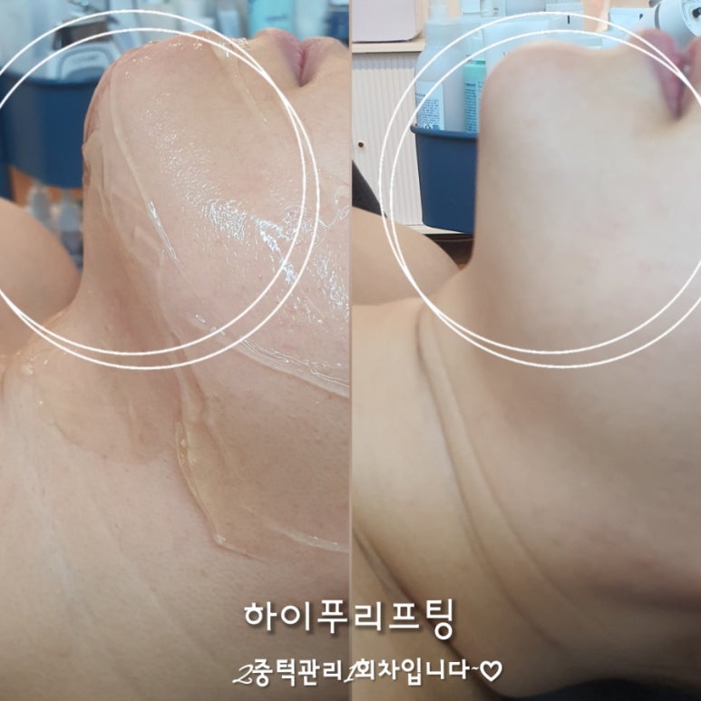 뷰티하리 김포점 이미지