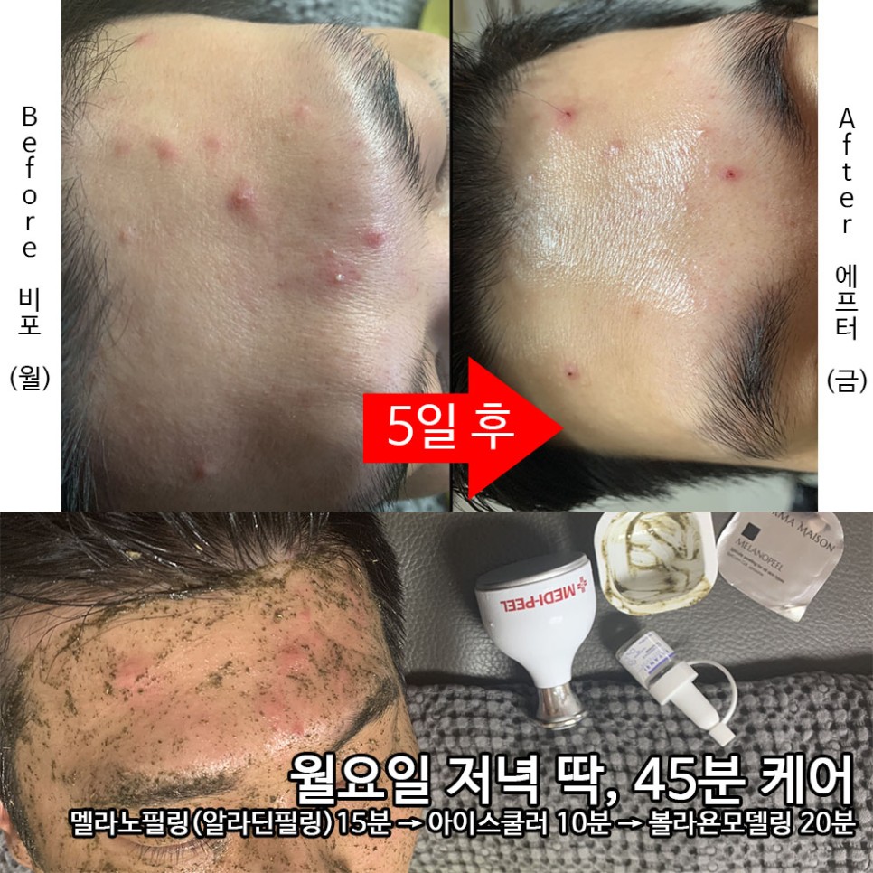 원탑공구 이미지