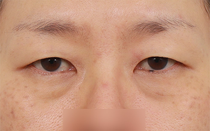 지인성형외과 이미지