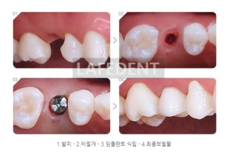 라페치과 이미지