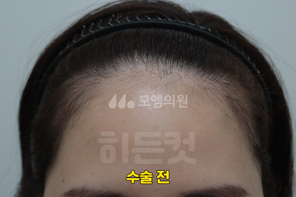 심미헤어 이미지