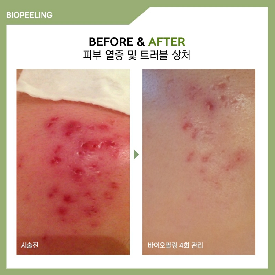 피부를바꾸다 이미지