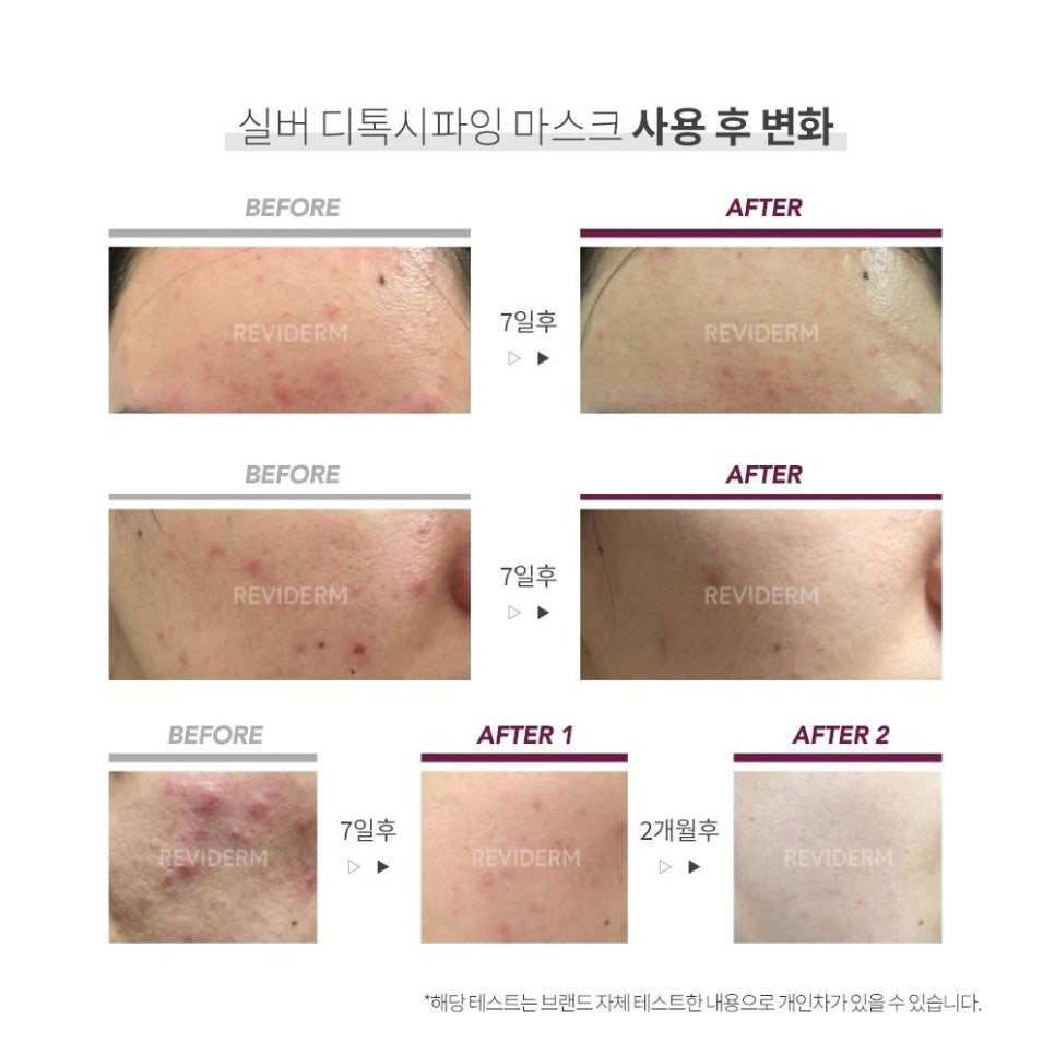 디톡시 이미지