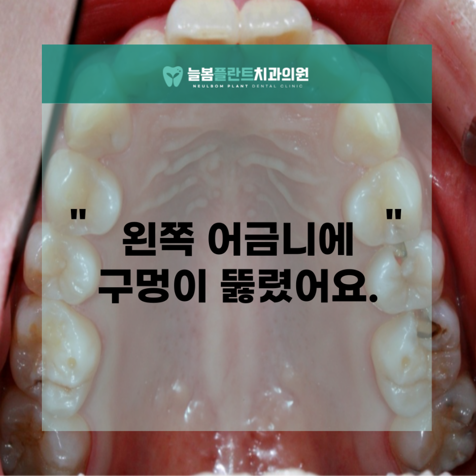 늘봄플란트치과 이미지