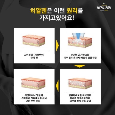 글로우에스테틱 이미지