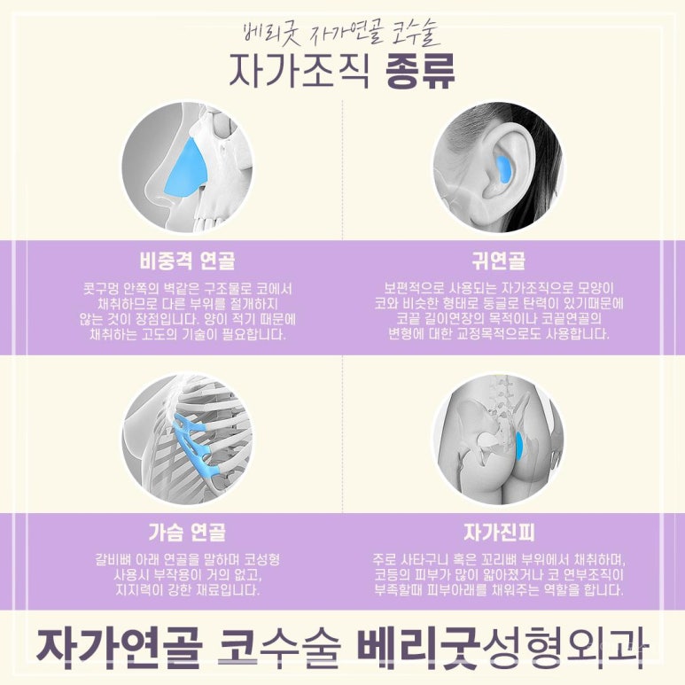 베리코 이미지