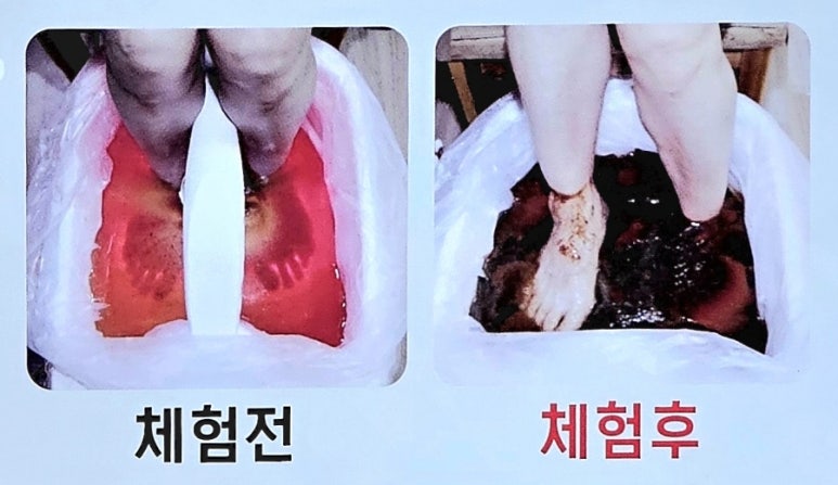 족욕힐링숲라파 이미지