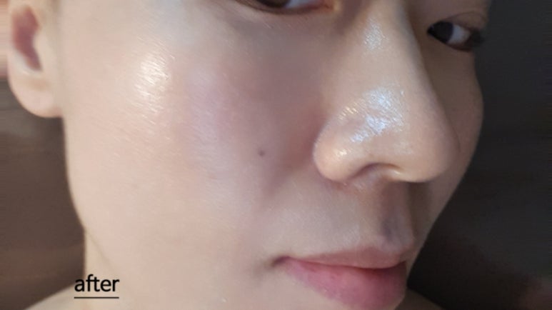 S바디앤스킨 이미지