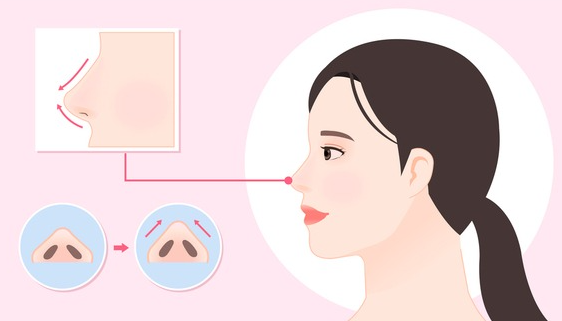 디엘의원 이미지