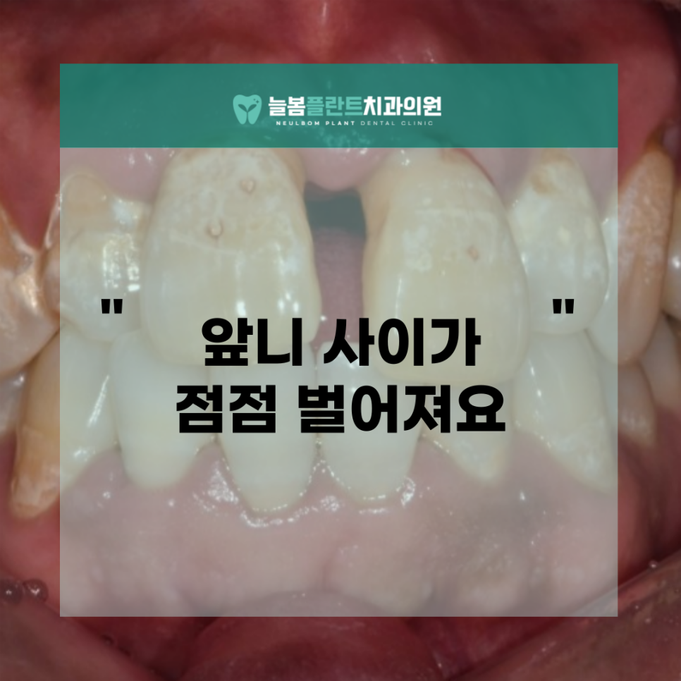 늘봄플란트치과 이미지