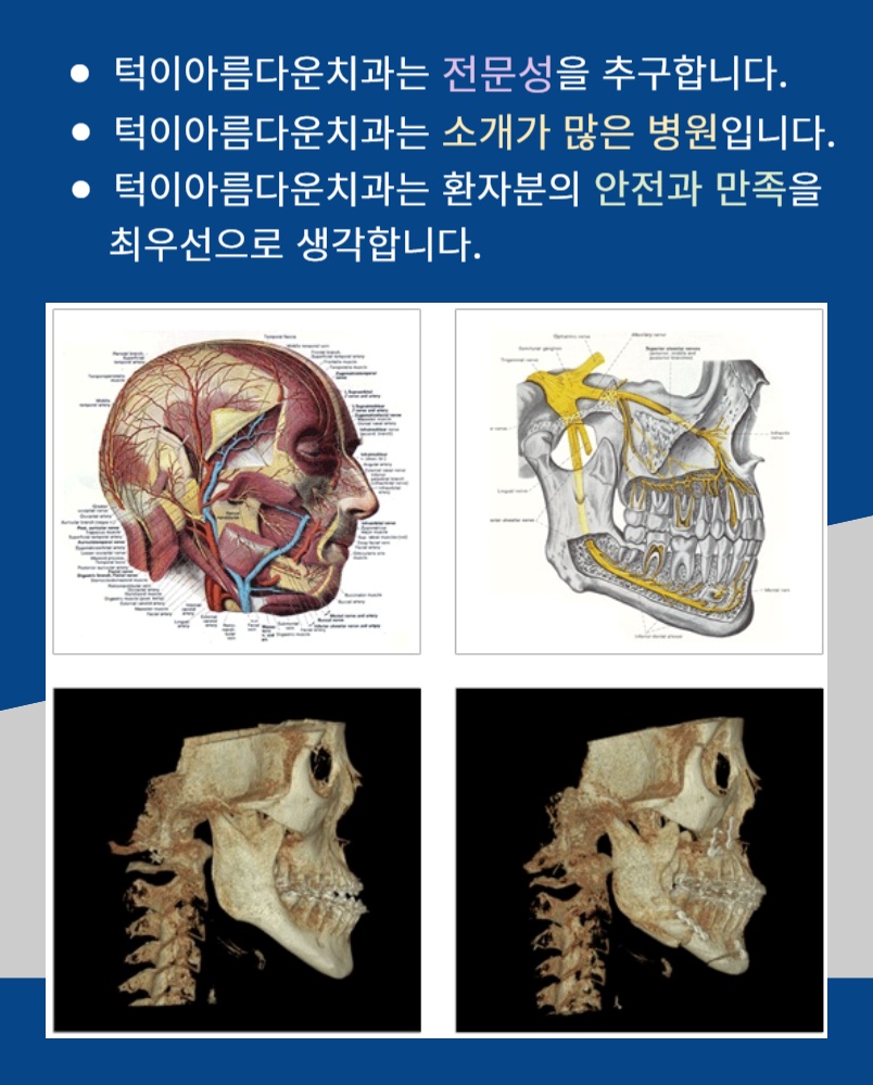 턱이아름다운치과 이미지
