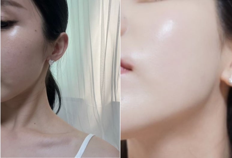 프로즌루틴 이미지
