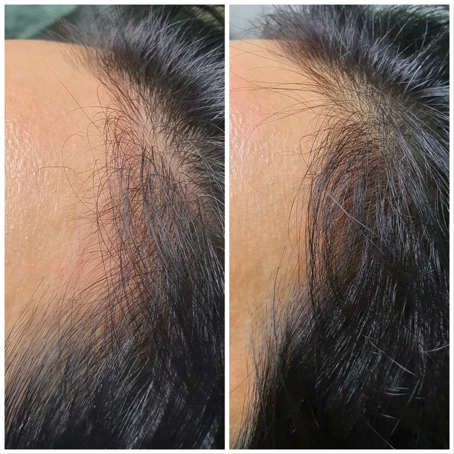 권헤어라인 이미지