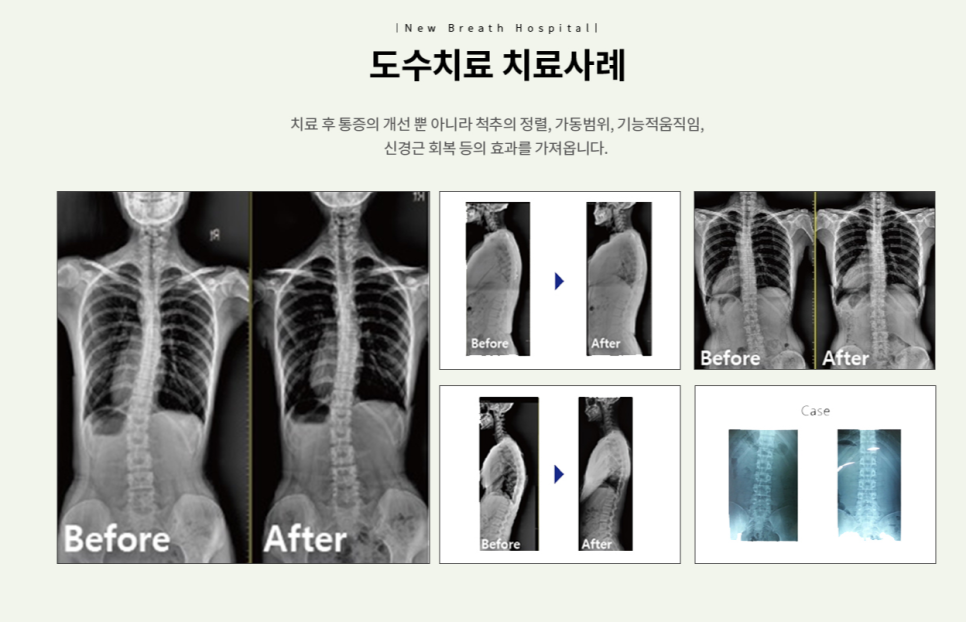 새숨병원 이미지