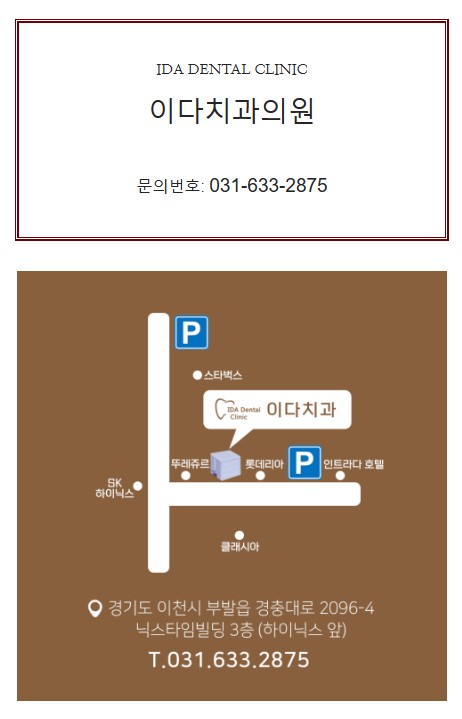 두찜이천 이미지