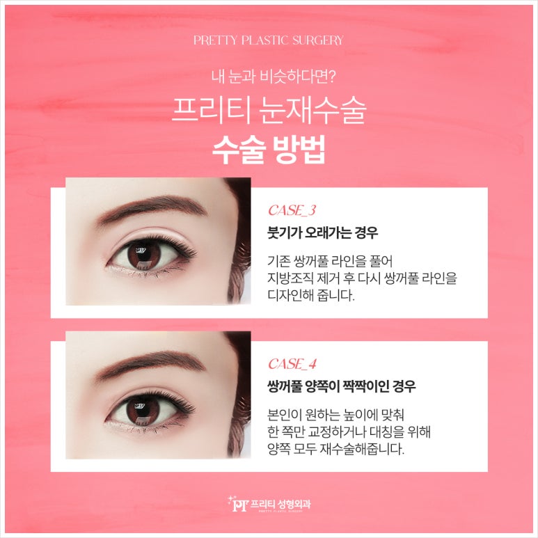 훌륭성형외과 이미지