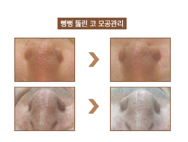 팜스테라 이미지