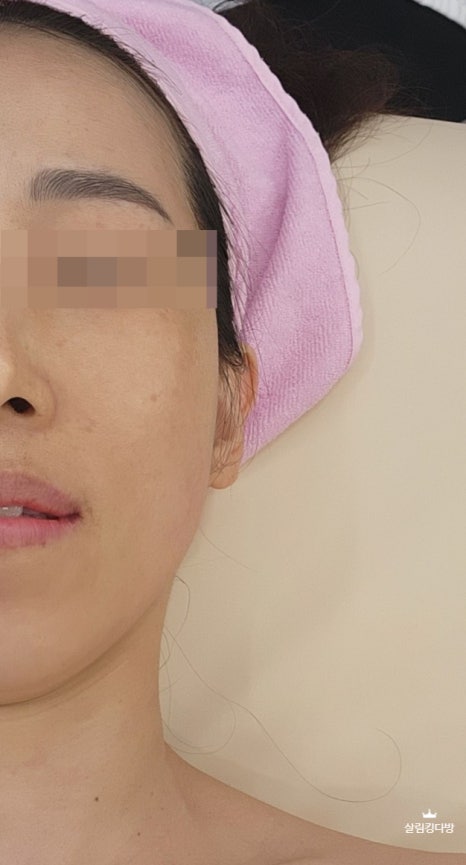 코코넛 피부샵 이미지