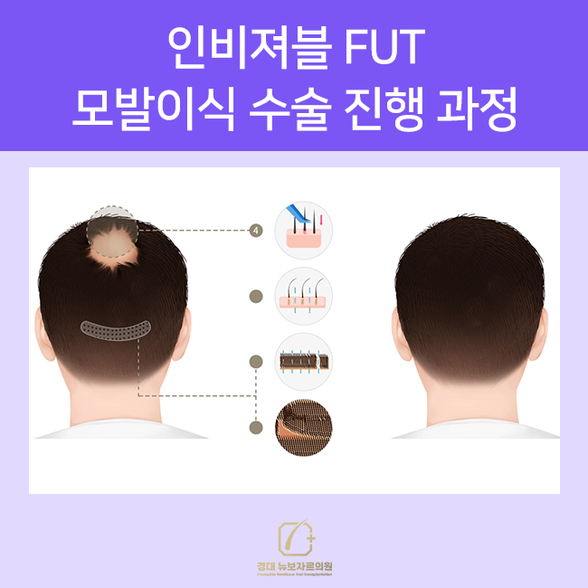 경대뉴보자르의원 이미지