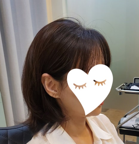 마이크로헤어증모 이미지