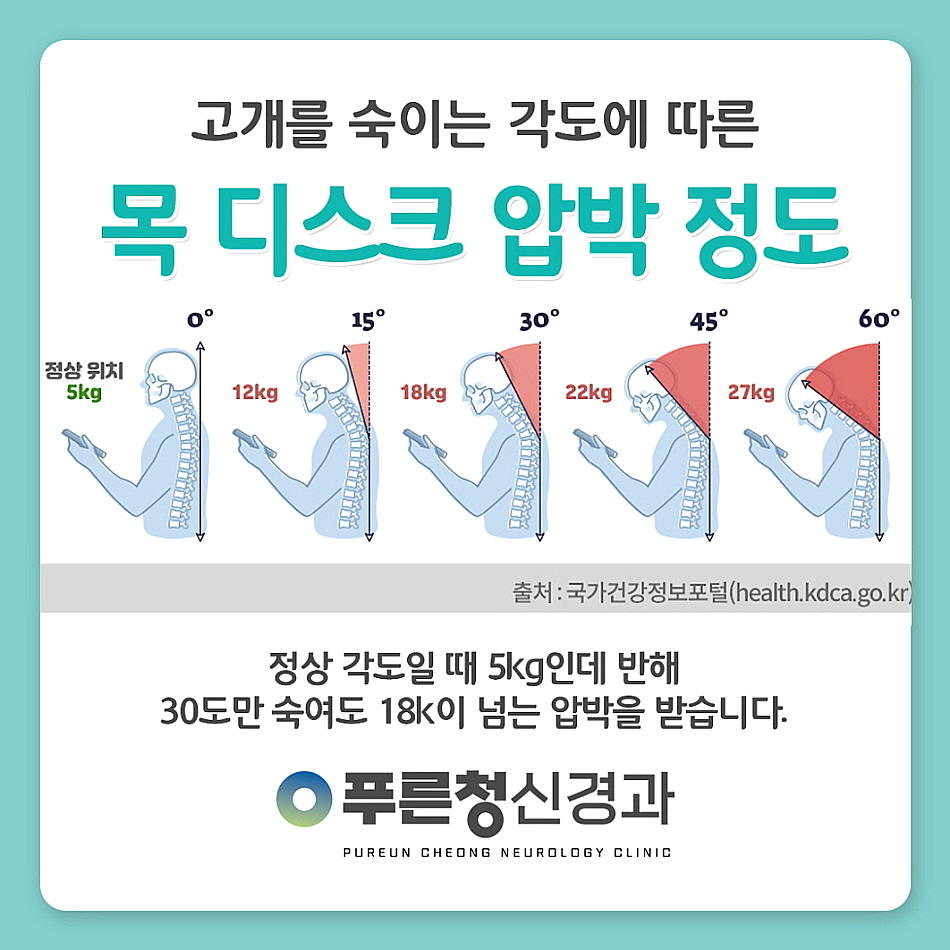 수성신경과 이미지