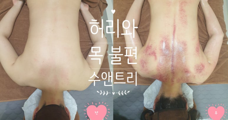수앤테라피 이미지