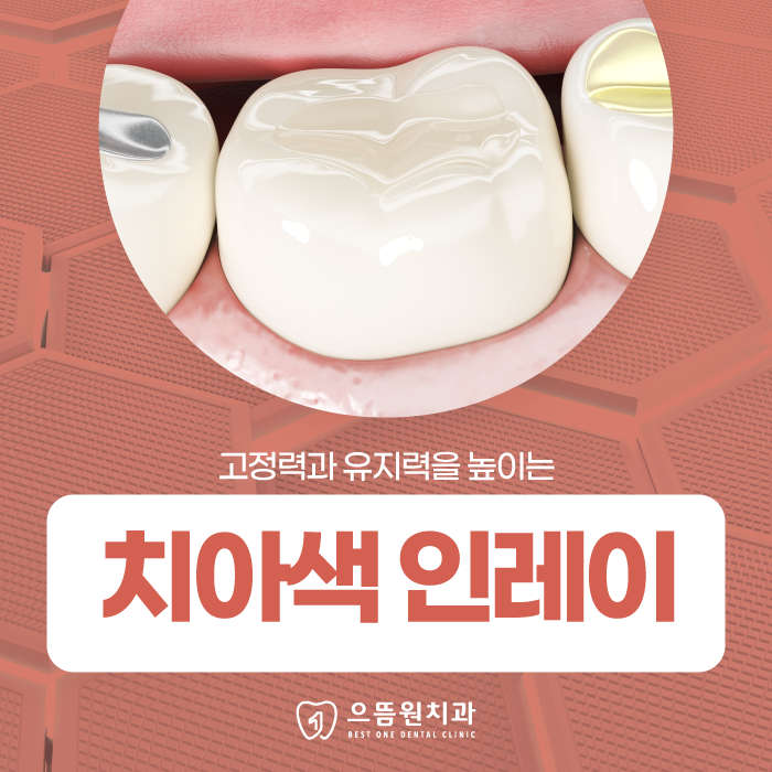 으뜸원치과의원 이미지