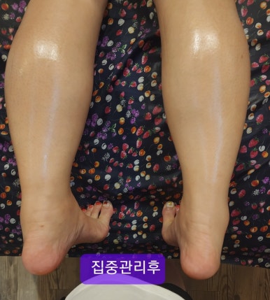 알포유 이미지