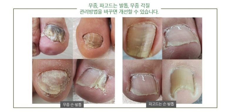 큐릭스 이미지
