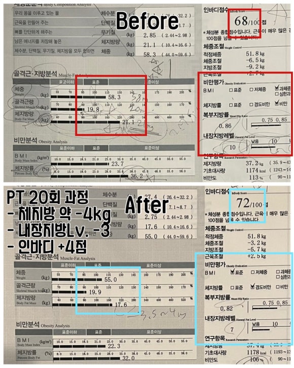 애프터20 이미지