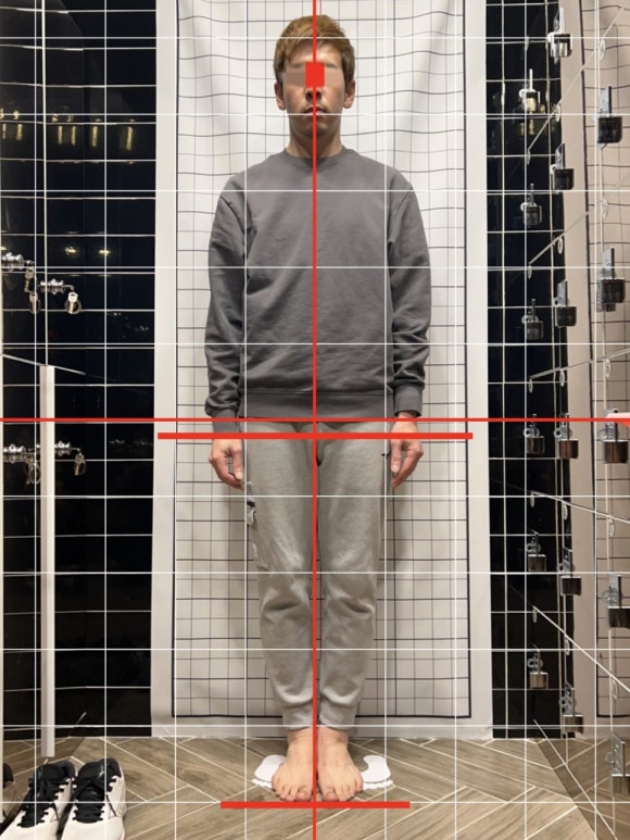 애프터20 이미지