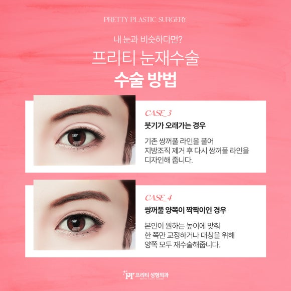 훌륭성형외과 이미지
