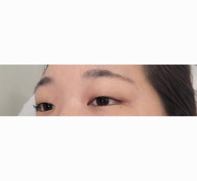 비브로우 이미지