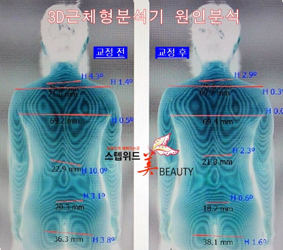위드관리 이미지
